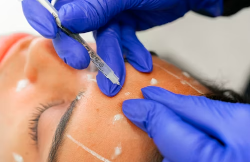 Botox Treatment in Lahore